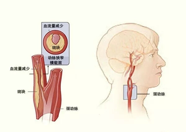 圖文圖片