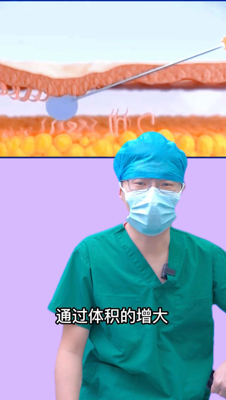 視頻封面