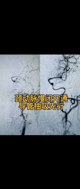 視頻封面