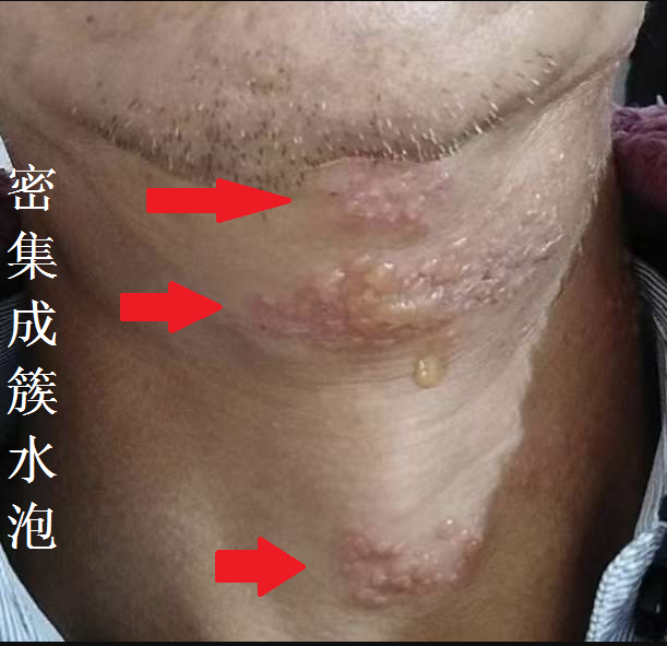 圖文圖片
