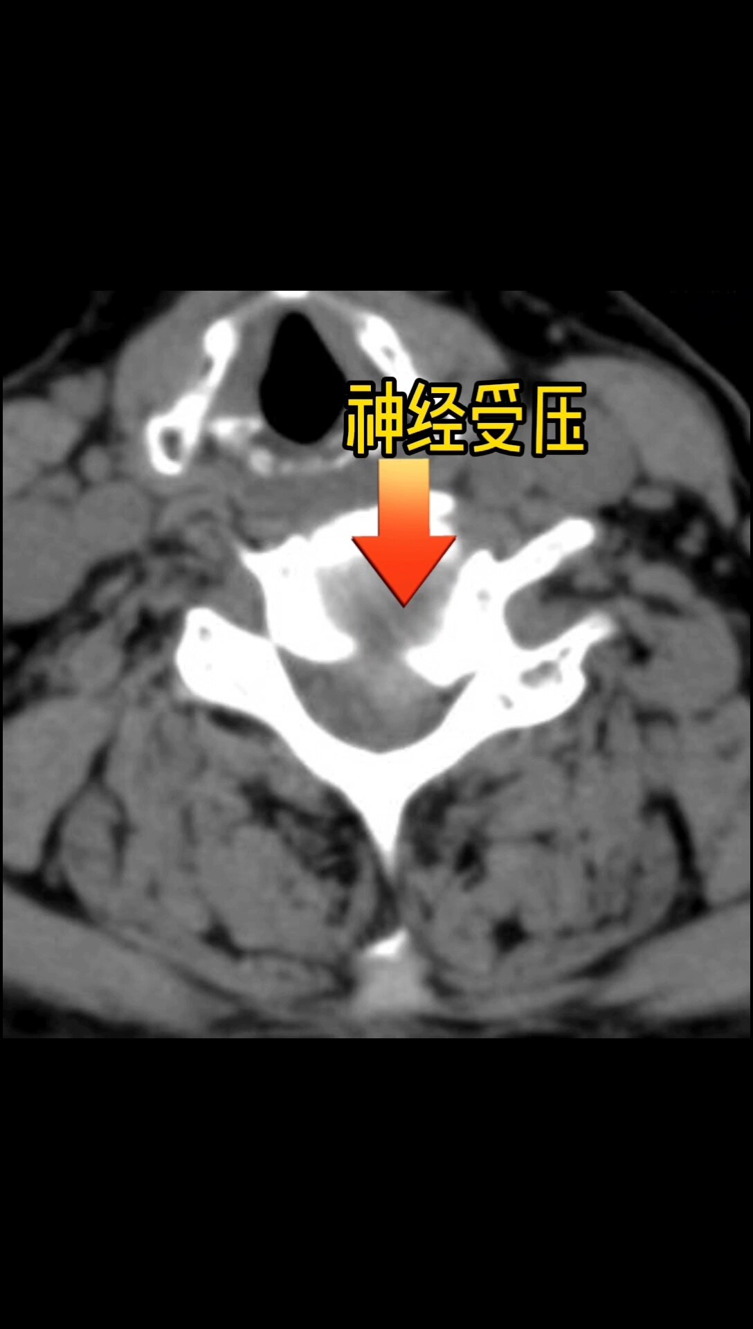 默认图片