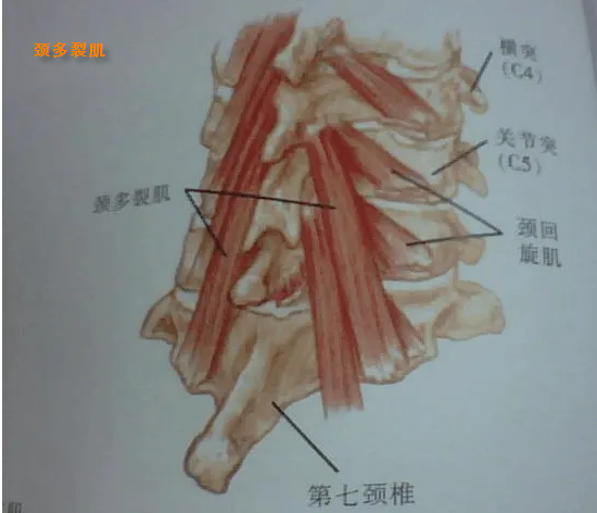 多裂肌的起止点图片