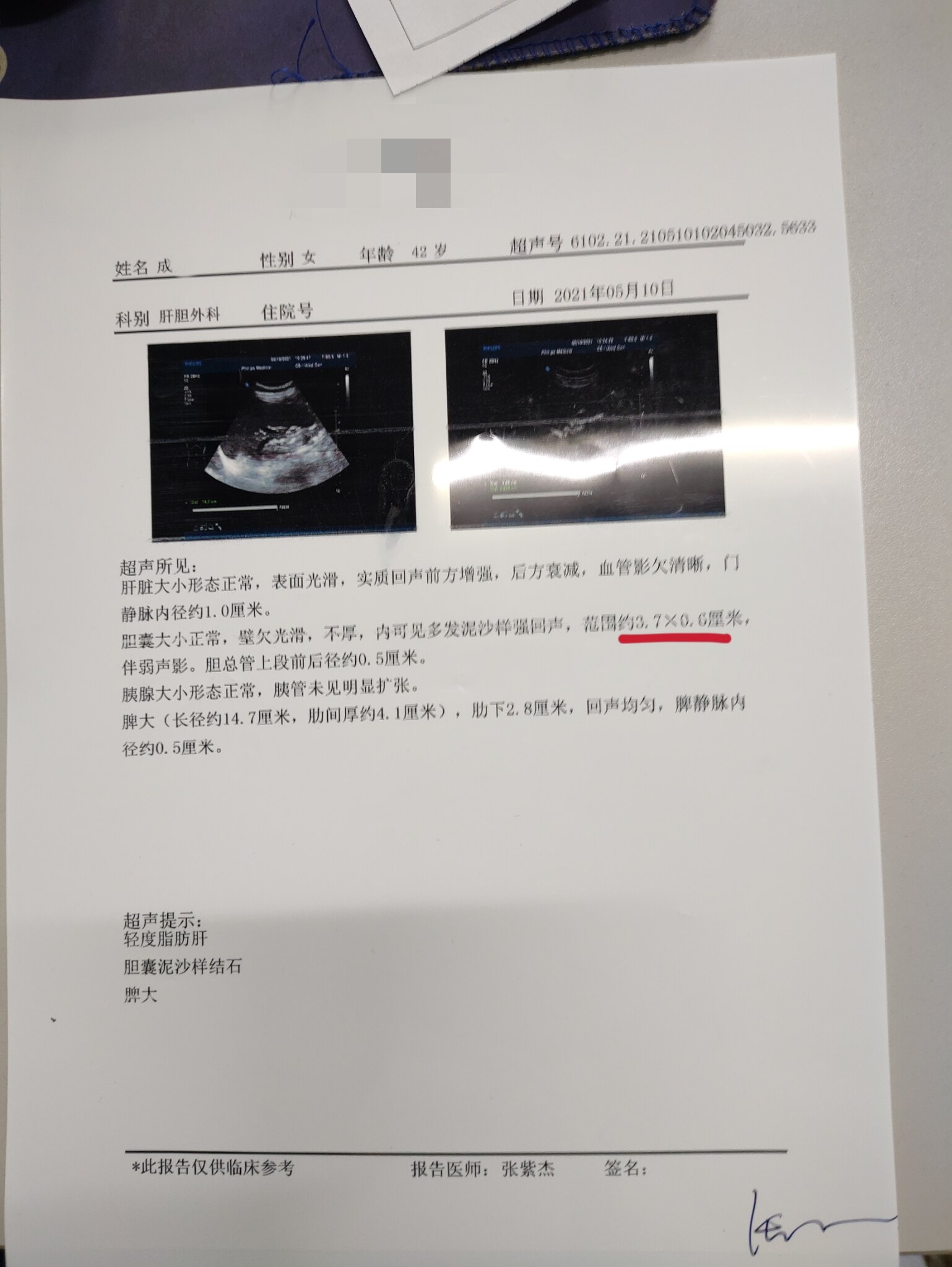 泥沙样结石用药两月明显缩小 - 好大夫在线