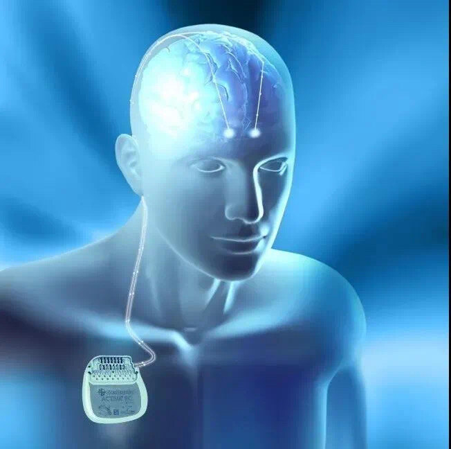 帕金森_帕金森治疗方式 - 好大夫在线