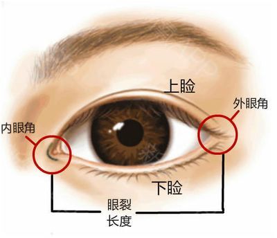 一般都是指开内眼角手术,内眼角是上下眼睑内侧结合的位置,开内眼角并