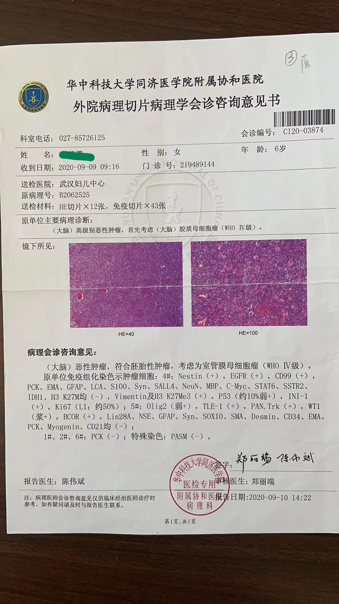 复发性室管膜瘤/室管膜母细胞瘤(女,7岁6月)1例报告并文献复习_室管膜