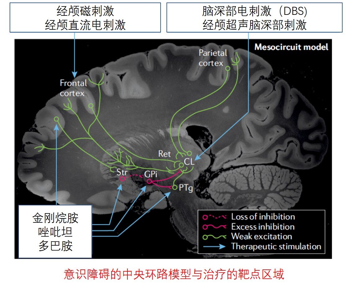 中央环路模型.jpg