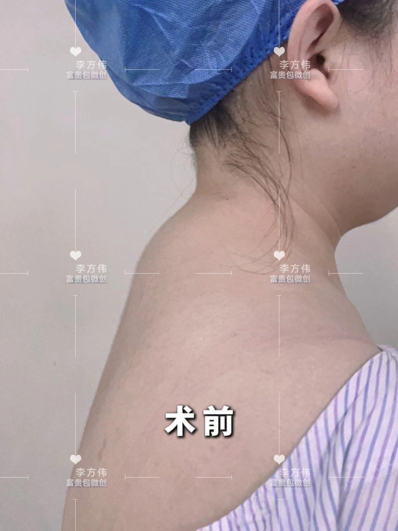 圖文圖片