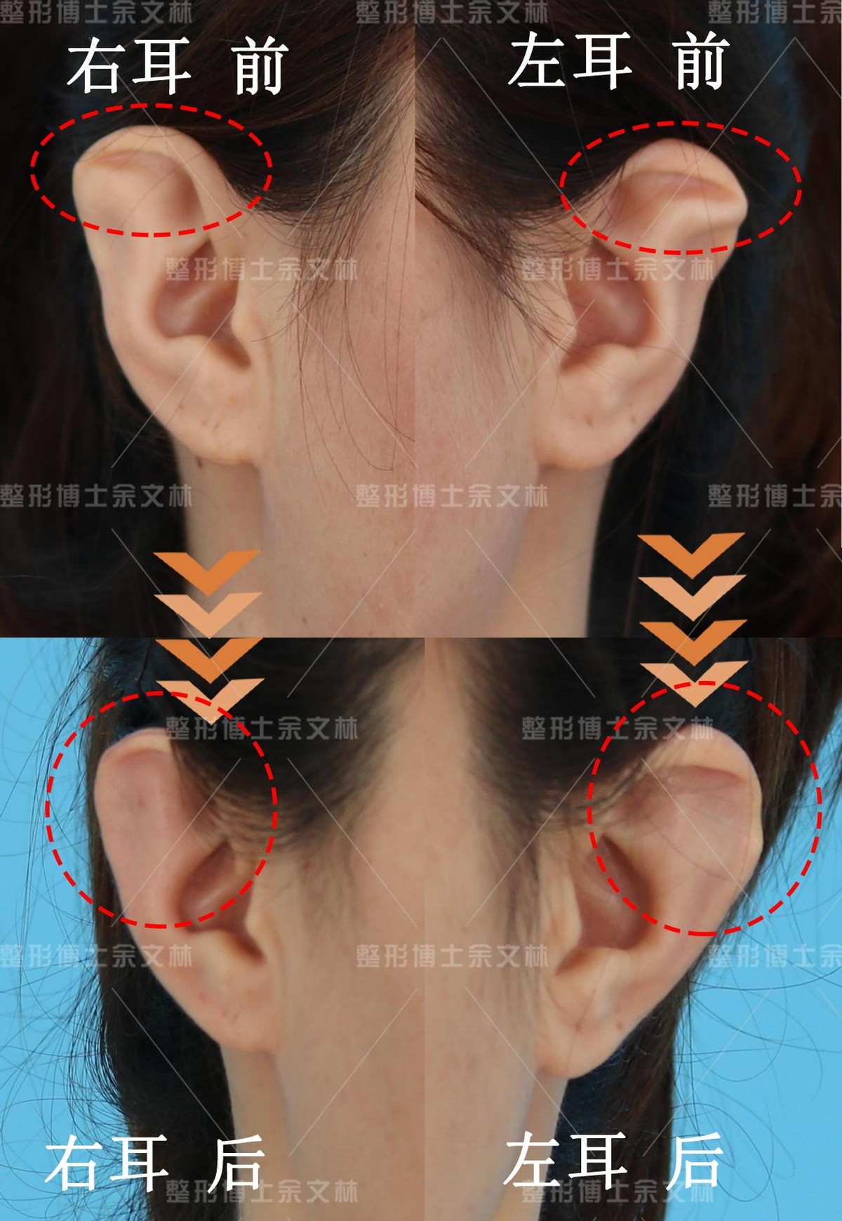 耳朵反骨的女生图片
