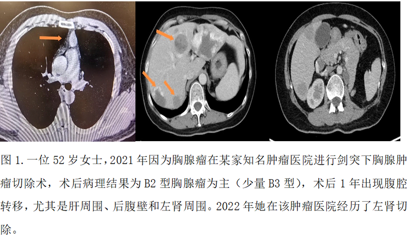 圖文圖片