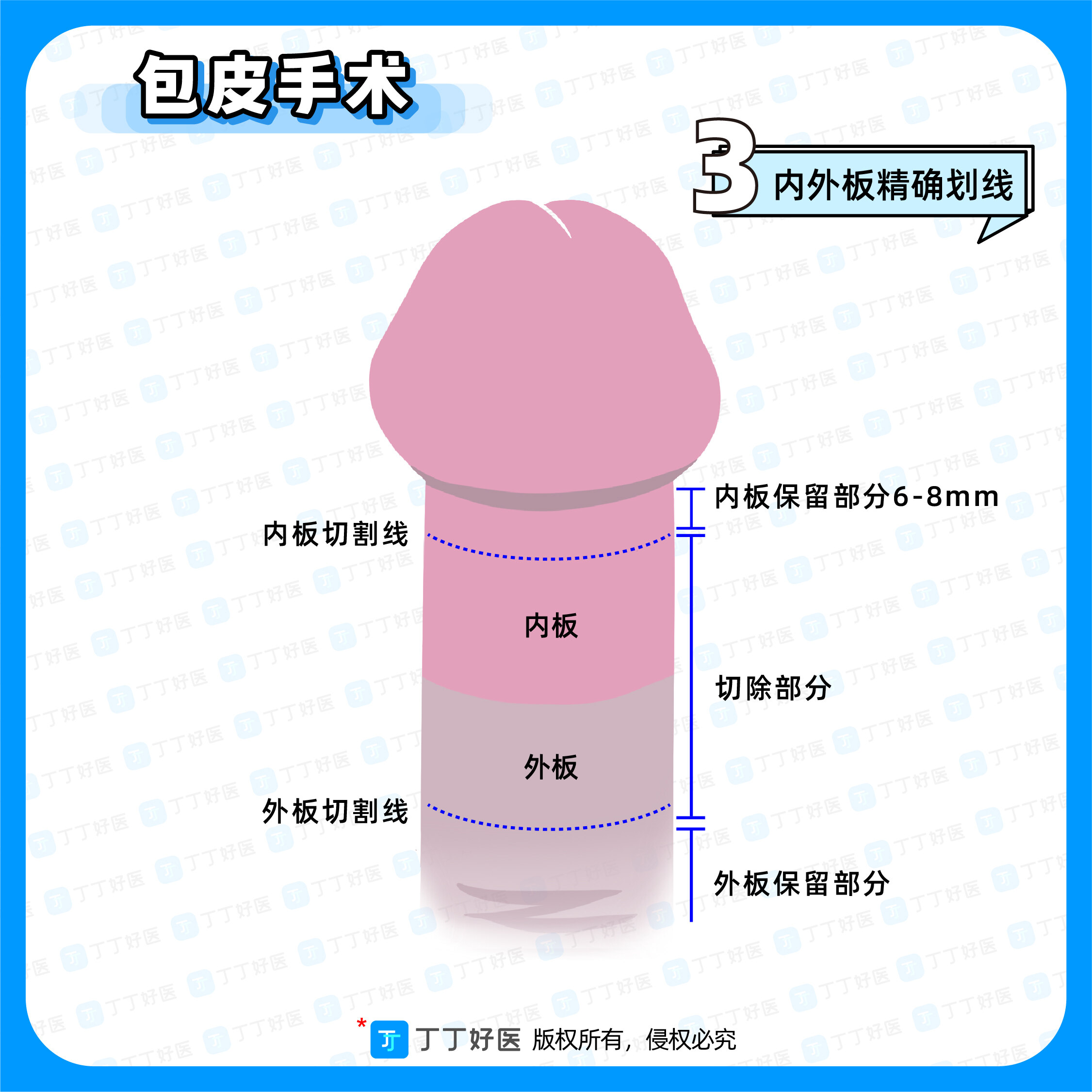 图文图片