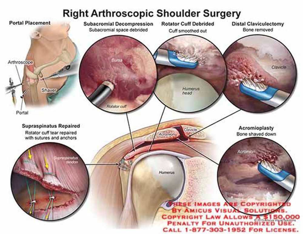 蛇身疮的最早症状 1YYBAGXK1euAYmfrAA33GvXCQP4373.png?_ms_=5524