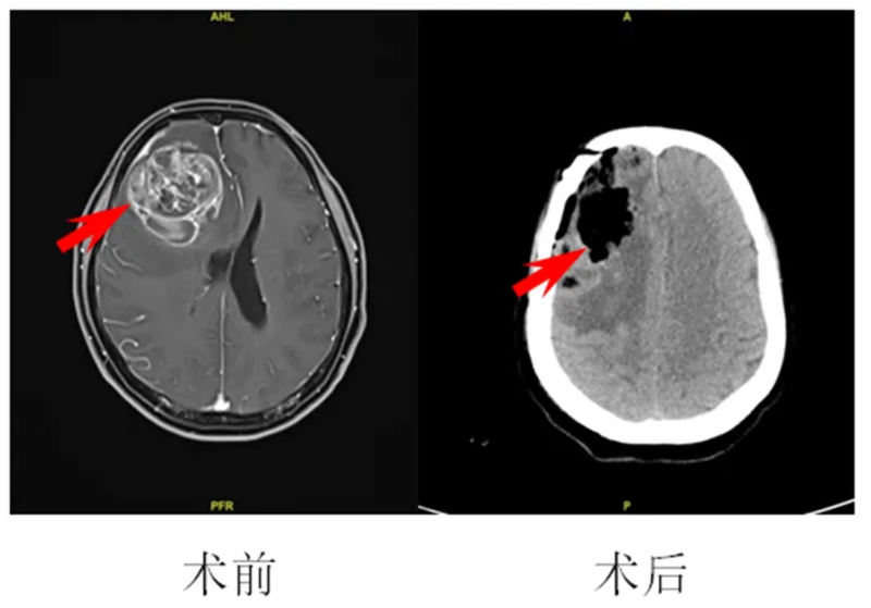 圖文圖片