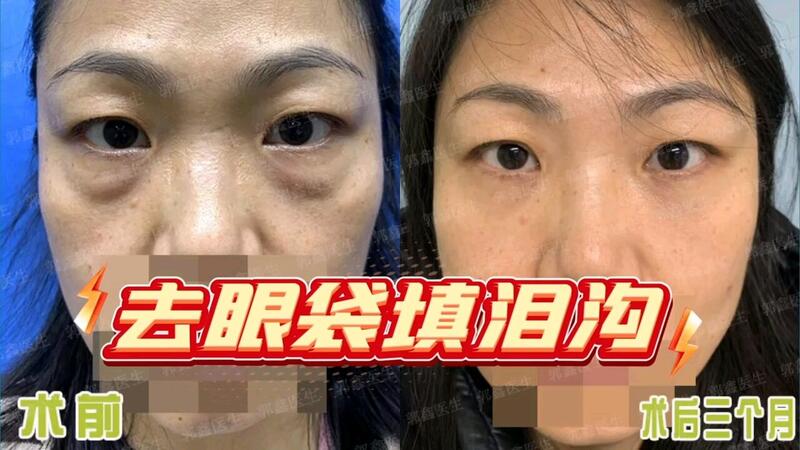 視頻封面
