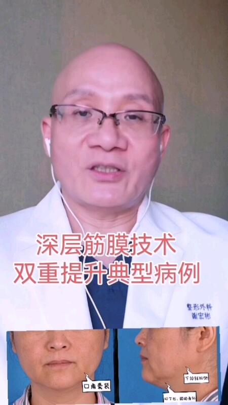 視頻封面