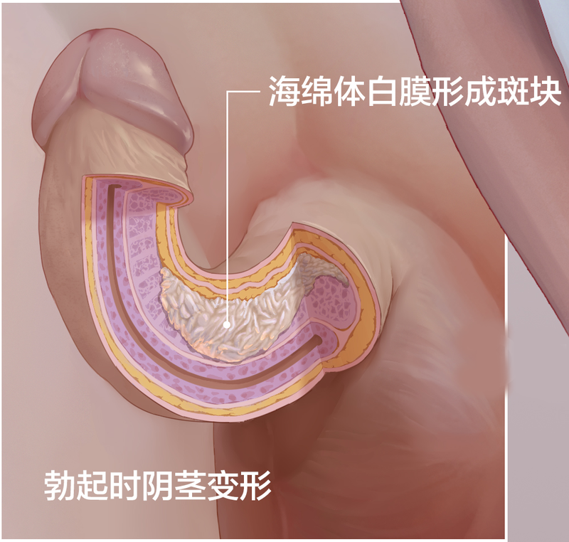 圖文圖片