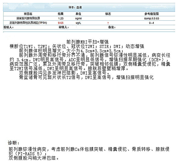 前列腺癌的早期诊断和治疗_前列腺癌_前列腺癌治疗方式 - 好大夫在线