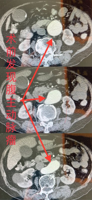 圖文圖片