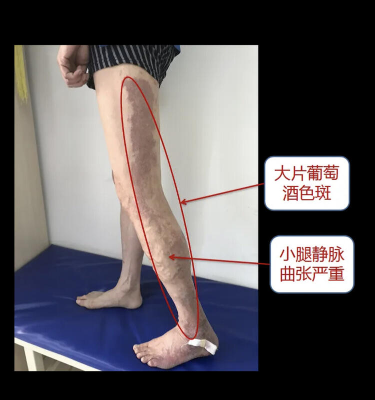 圖文圖片