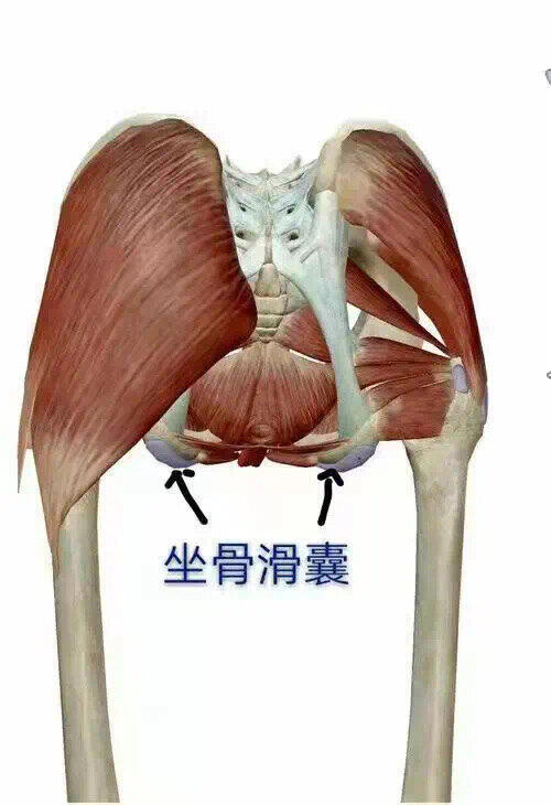 股骨大转子滑囊炎图片