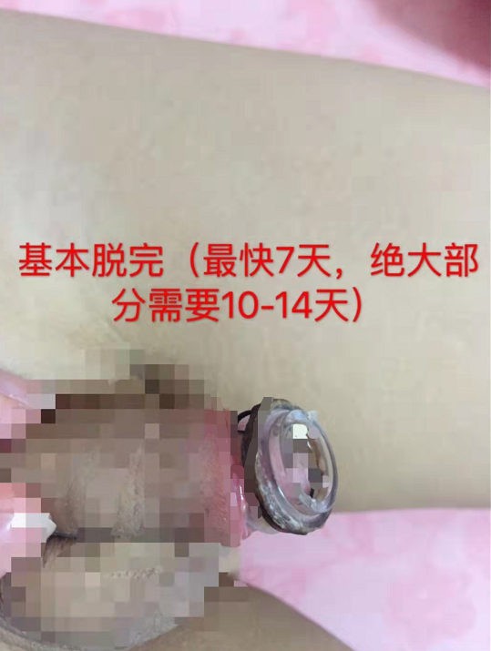 9a23fddfacde03112994b5764b34895.png