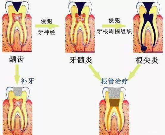 圖文圖片