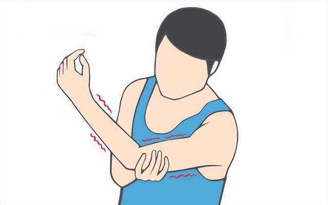 如果患者出现肩关节的活动受限,还有一些肩膀僵硬,包括肩部的压痛