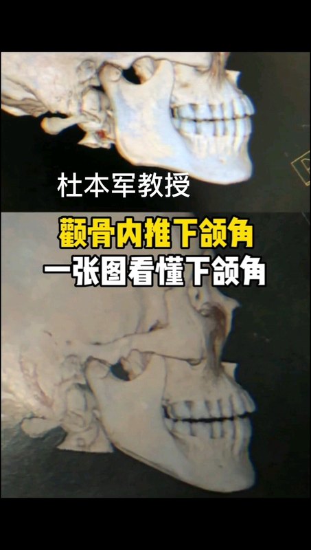 視頻封面