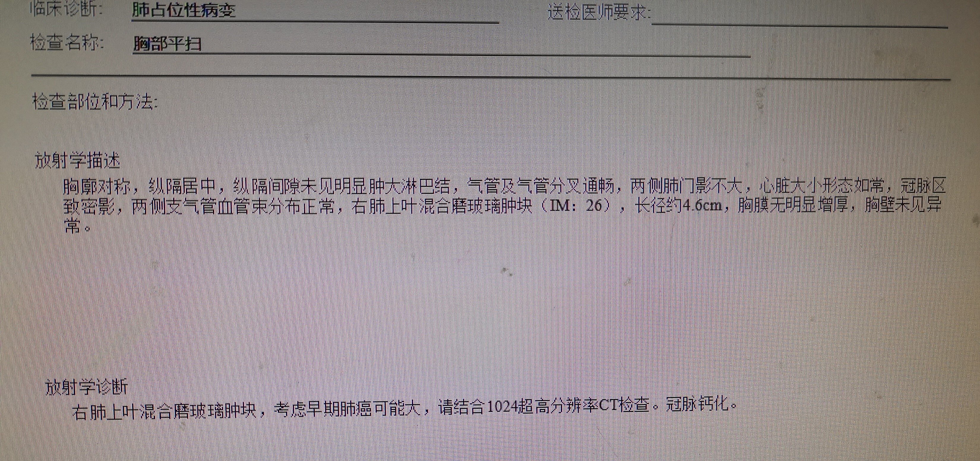 怎么才能检测出肺癌 1YYBAGIJ6HWARv9kAByf7Qg25Dk346.jpg?_ms_=aae1
