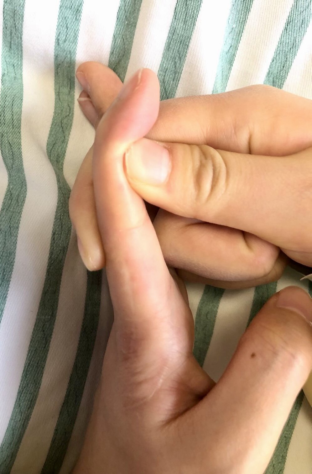 手部无人区2区屈指肌腱粘连