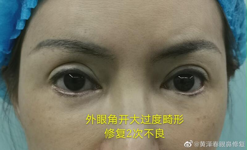 圖文圖片