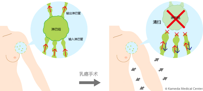 圖文圖片