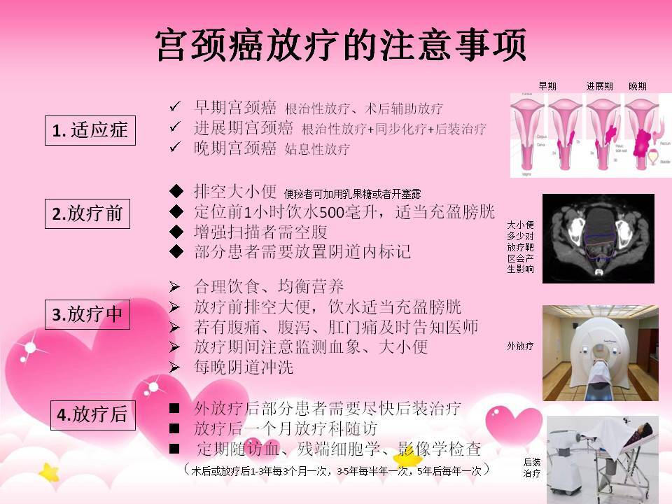 宫颈癌：女性健康的隐形杀手
