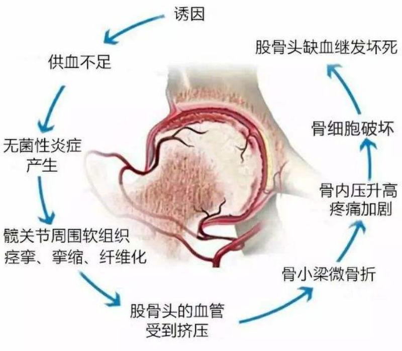 圖文圖片