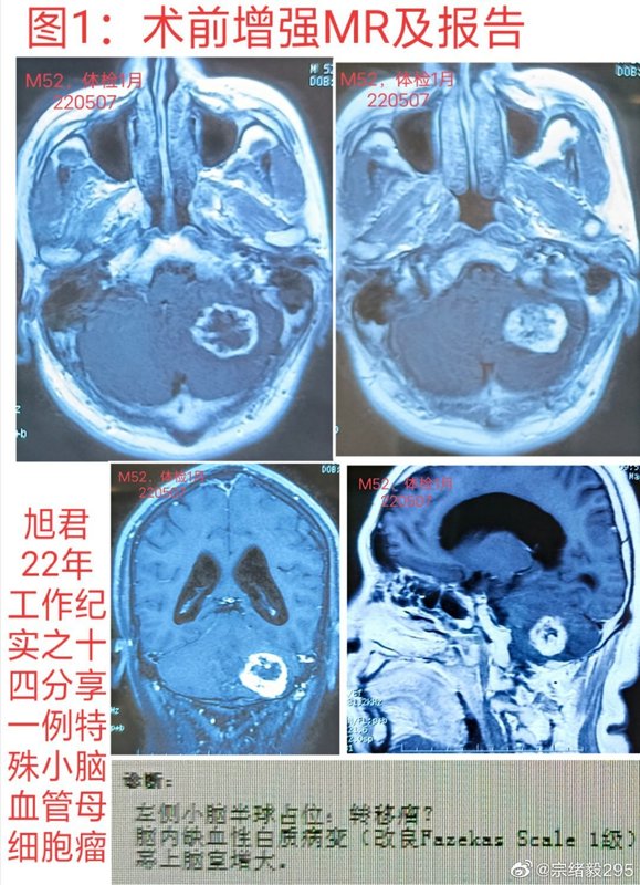圖文圖片