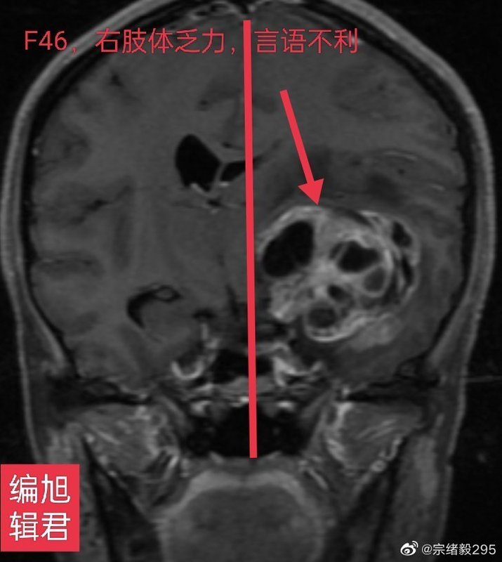 圖文圖片