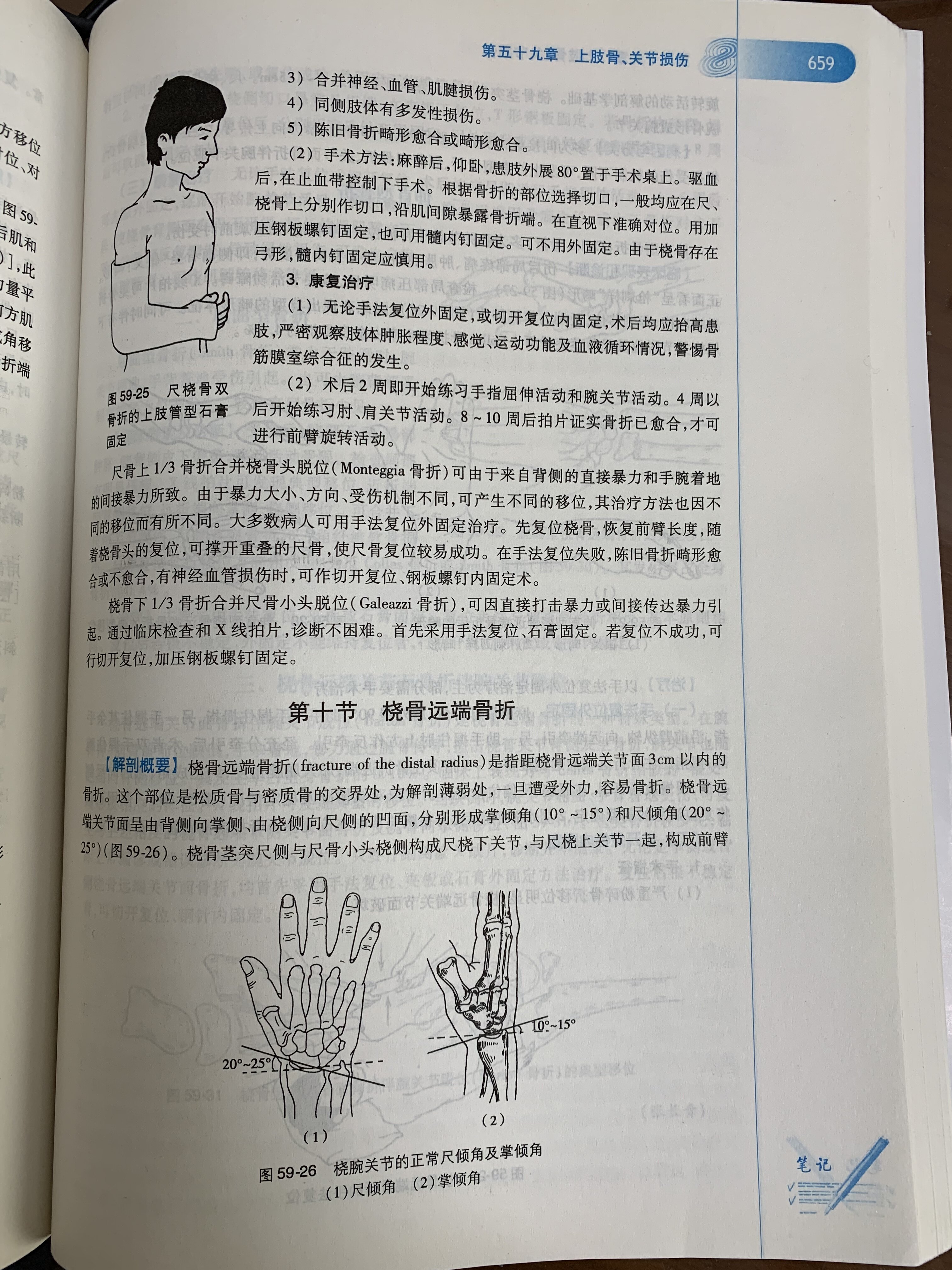 图09. 本科生教材桡骨远端骨折1.jpg