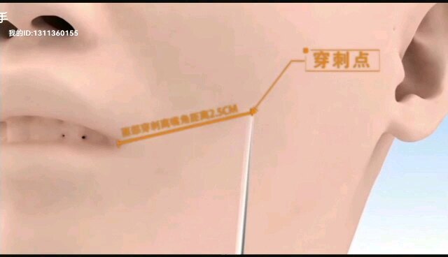 視頻封面