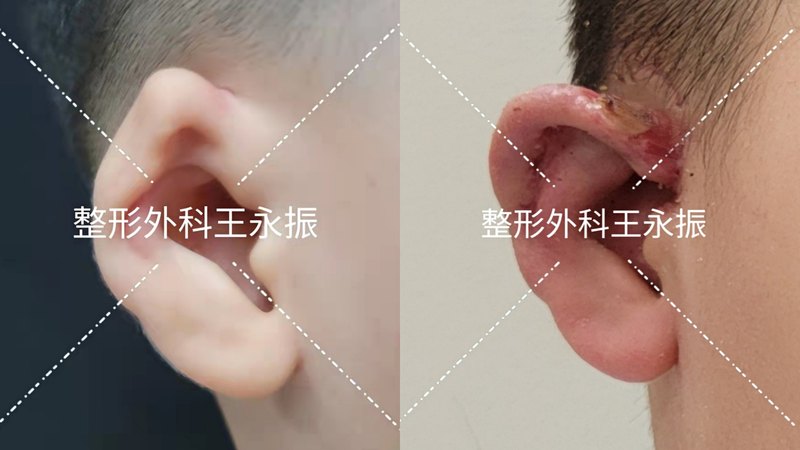 圖文圖片
