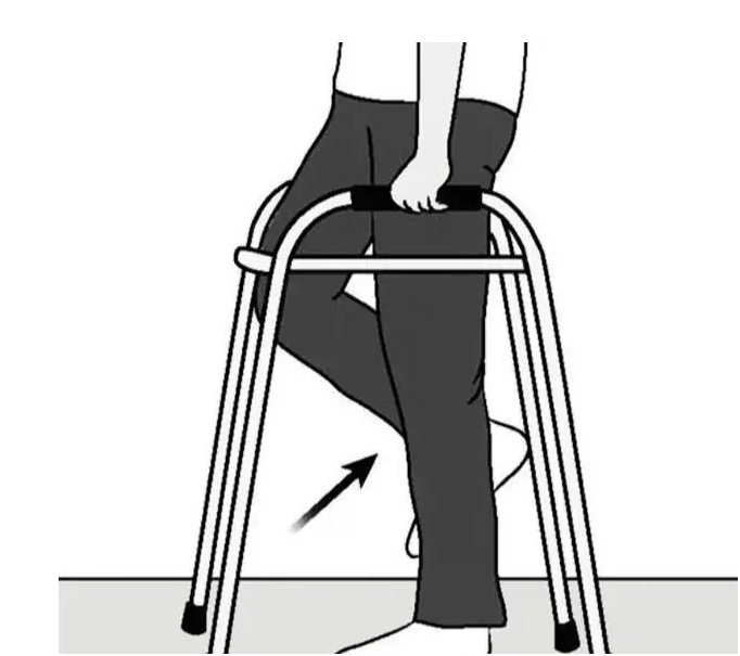 人工全膝及单髁置换术后如何康复锻炼(必读)_人工关节置换术_人工关节