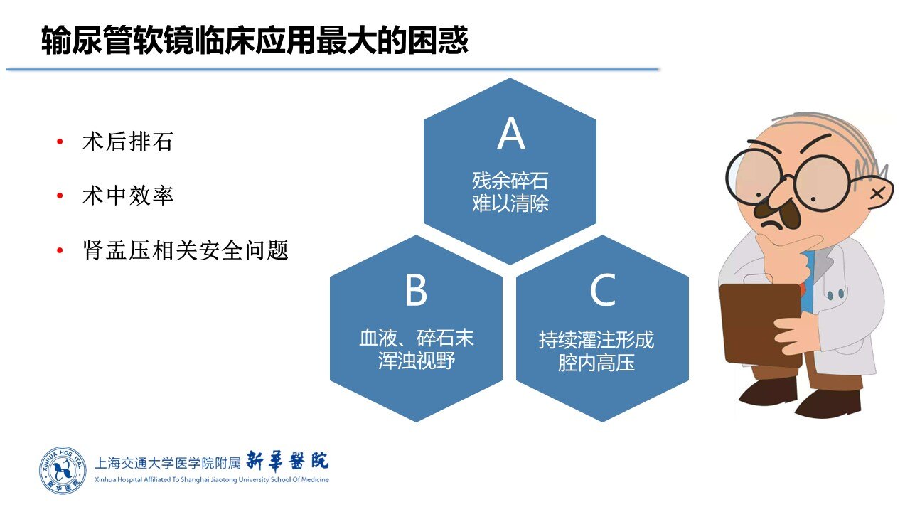 可弯负吸鞘软镜清石技术的临床应用体会.jpg