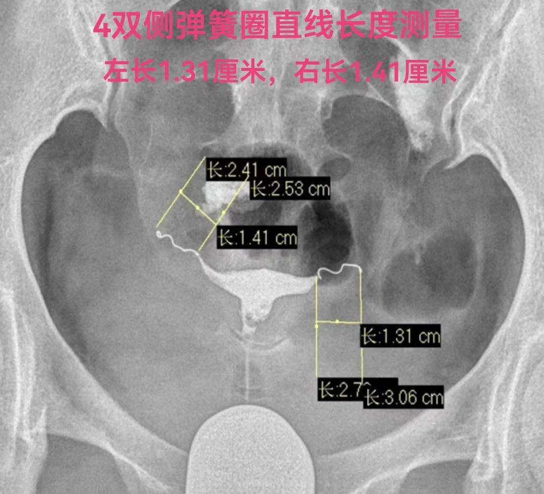 圖文圖片