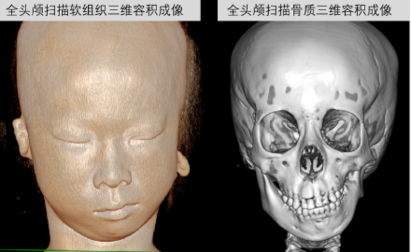 圖文圖片