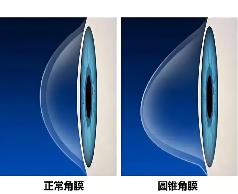 圖文圖片