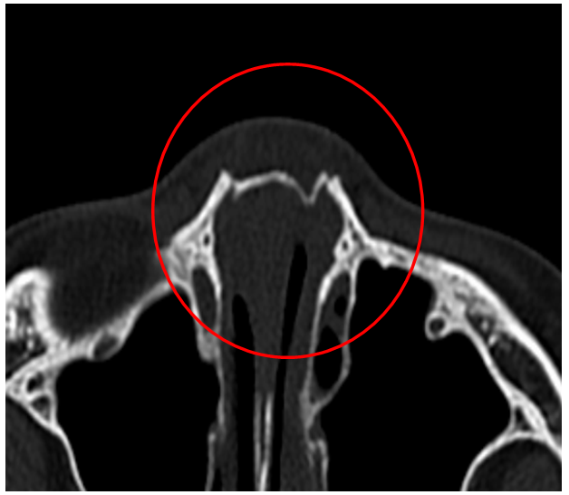 R5dw 5wolxjvmm R5dw 5wolxjvmm