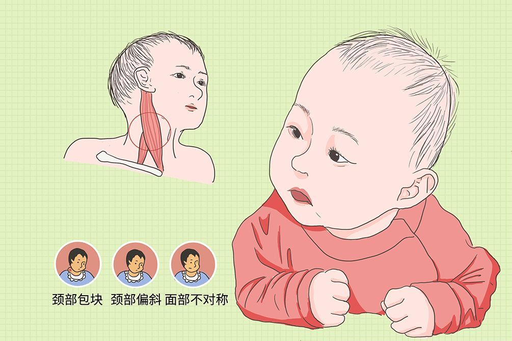 圖文圖片