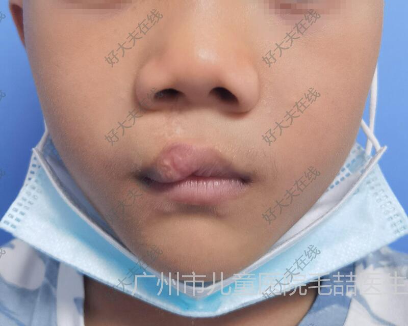 圖文圖片