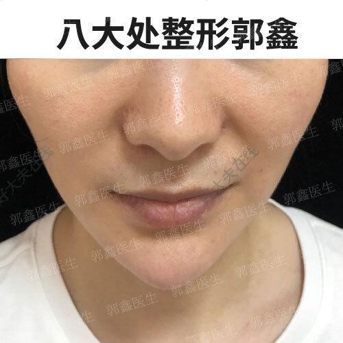 圖文圖片