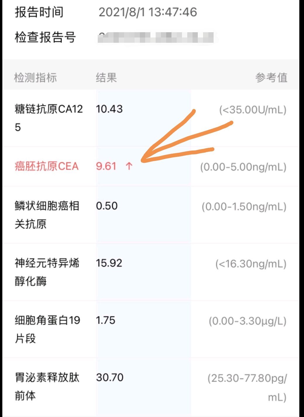 癌胚抗原多少钱做一次 14YBAGI-nFyATX5UAAFzMi4fk3w741.jpg?_ms_=8c29