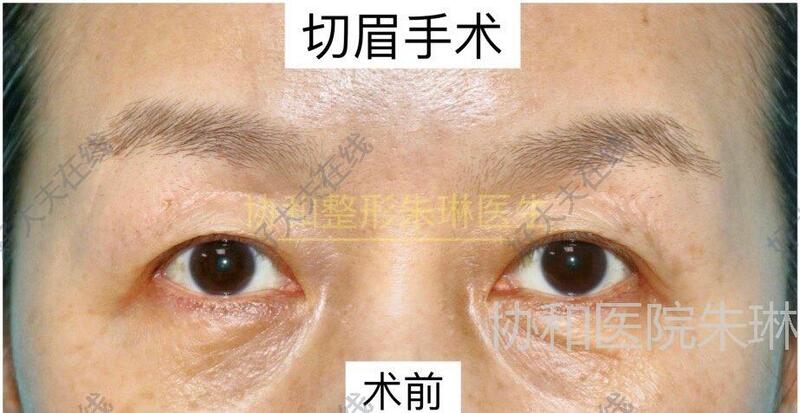 圖文圖片